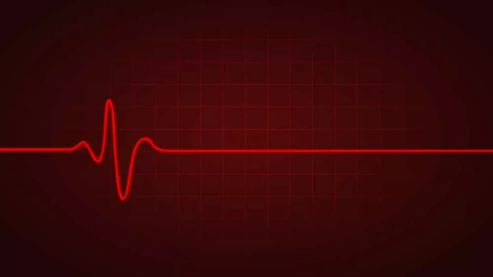 From digital to health: how does France ensure the protection of personal data of deceased persons?